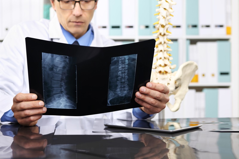 Spinal specialist reviewing x-rays of the spine